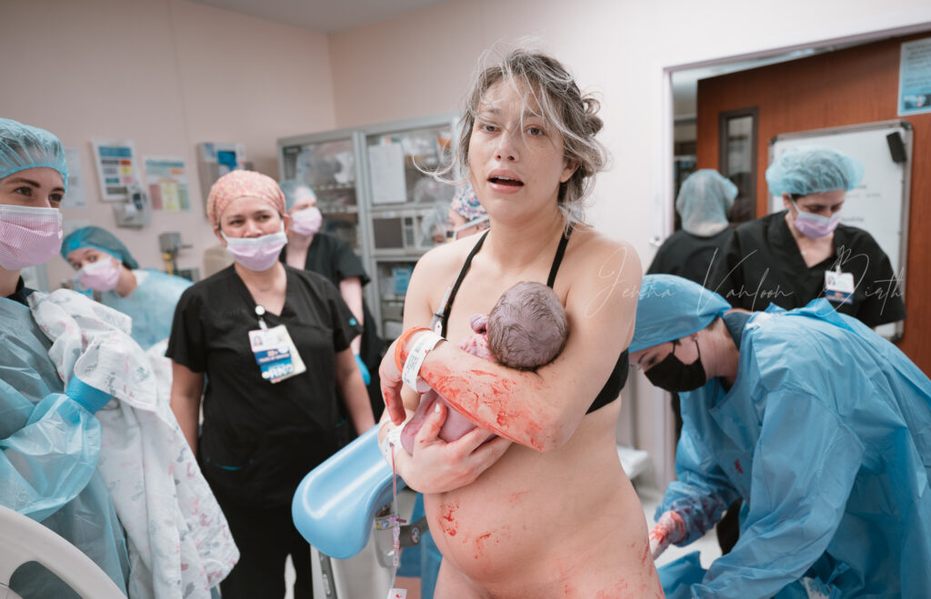 The face of a mother who delivered a vaginal breech baby

